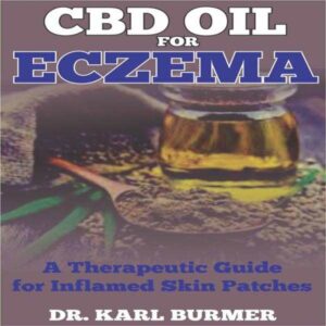 CBD Oil for Eczema: A Therapeutic Guide for Inflamed Skin Patches , Hörbuch, Digital, ungekürzt, 32min