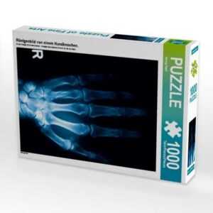 CALVENDO Puzzle "CALVENDO Puzzle Röntgenbild von einem Handknochen. 1000 Teile Lege-Größe 48 x 64 cm Foto-Puzzle Bild von Georg Hanf", 1000 Puzzleteile